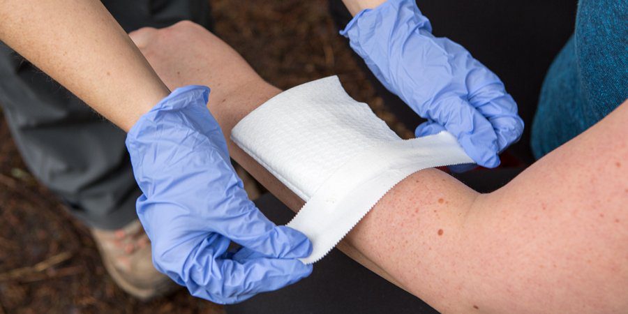 A person with blue gloves is waxing their arm.