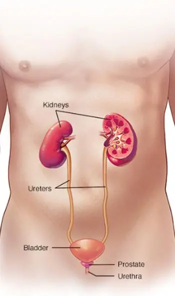 A diagram of the kidneys and listeriosis.